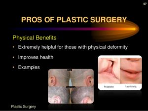 plastic-surgery-57-638