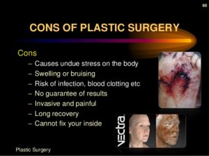 plastic-surgery-60-638